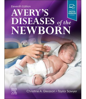 Avery's Diseases of the Newborn, 11th Edition