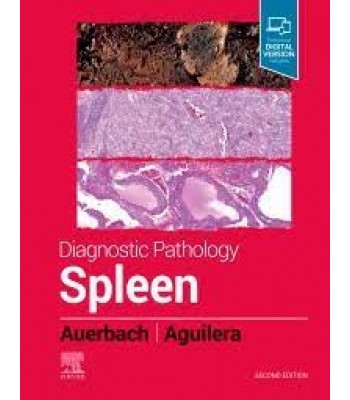 Diagnostic Pathology: Spleen, 2E 