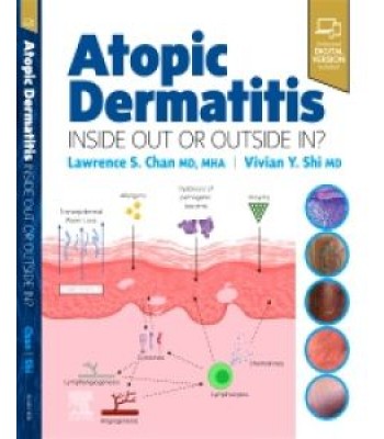 Atopic Dermatitis: Inside Out or Outside In 