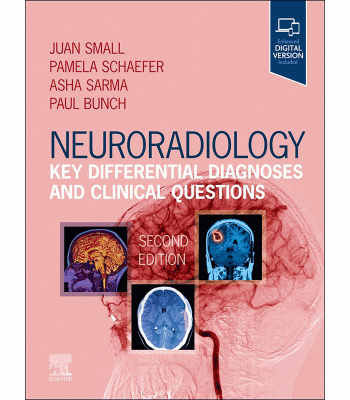 Neuroradiology: Key Differential Diagnoses and Clinical Questions, 2nd Edition