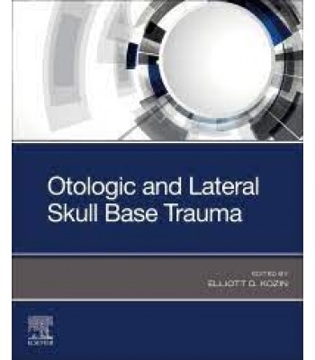 Otologic and Lateral Skull Base Trauma 