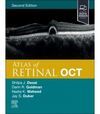 Atlas of Retinal OCT, 2nd Edition