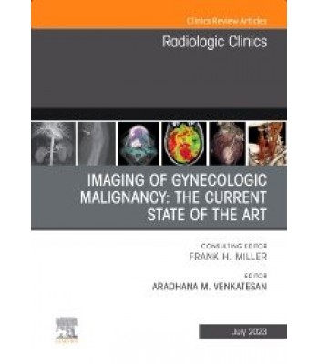 Imaging of Gynecologic Malignancy: The Current State of the Art, An Issue of Radiologic Clinics of North America, 1st Edition