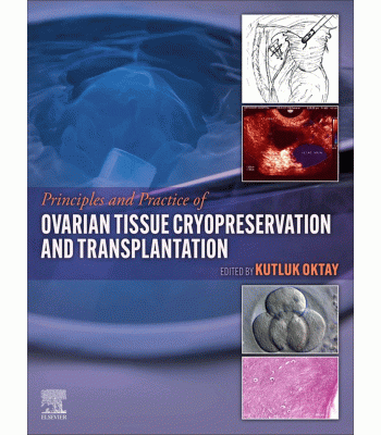 Principles and Practice of Ovarian Tissue Cryopreservation and Transplantation