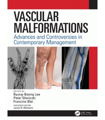 Vascular Malformations: Advances and Controversies in Contemporary Management