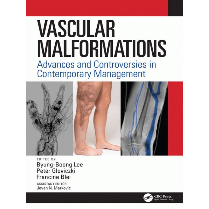 Vascular Malformations: Advances and Controversies in Contemporary Management