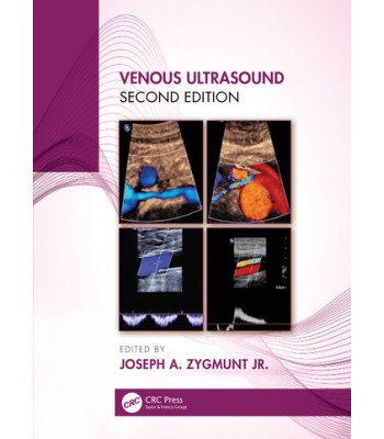 Venous Ultrasound 2nd edition
