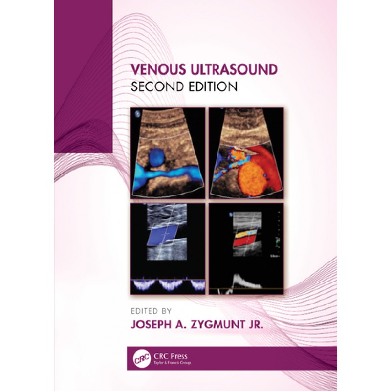 Venous Ultrasound 2nd edition
