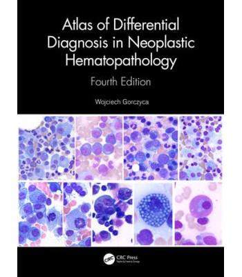 Atlas of Differential Diagnosis in Neoplastic Hematopathology 4E