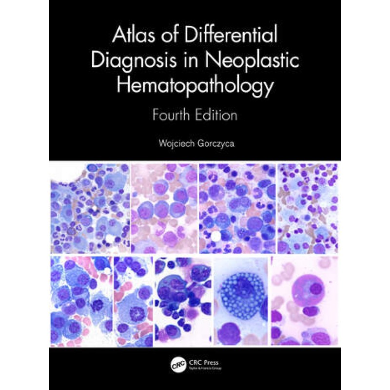 Atlas of Differential Diagnosis in Neoplastic Hematopathology 4E