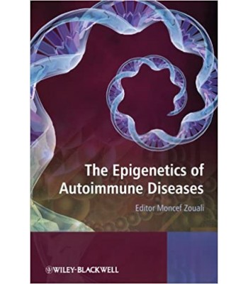 The Epigenetics of Autoimmune Diseases