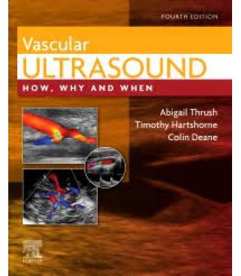 Vascular Ultrasound, 4E, How, Why and When