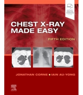 Chest X-Ray Made Easy, 5E 