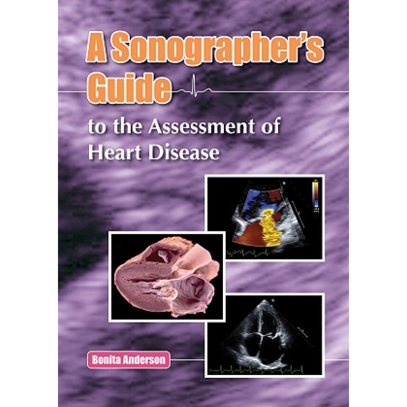 A Sonographer’s Guide to the Assessment of Heart Disease