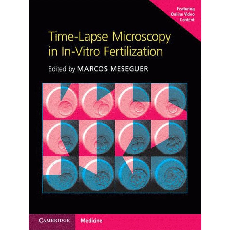 Time-Lapse Microscopy in In-Vitro Fertilization