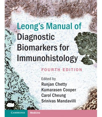 Leong’s Manual of Diagnostic Biomarkers for Immunohistology, 4E