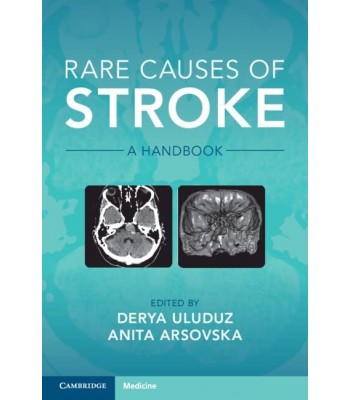 Rare Causes of Stroke A Handbook