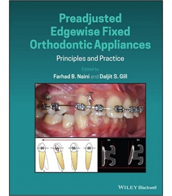 Preadjusted Edgewise Fixed Orthodontic Appliances: Principles and Practice