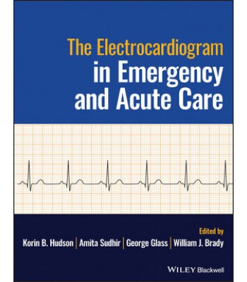 The Electrocardiogram in Emergency and Acute Care