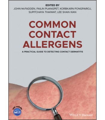 Common Contact Allergens: A Practical Guide to Detecting Contact Dermatitis