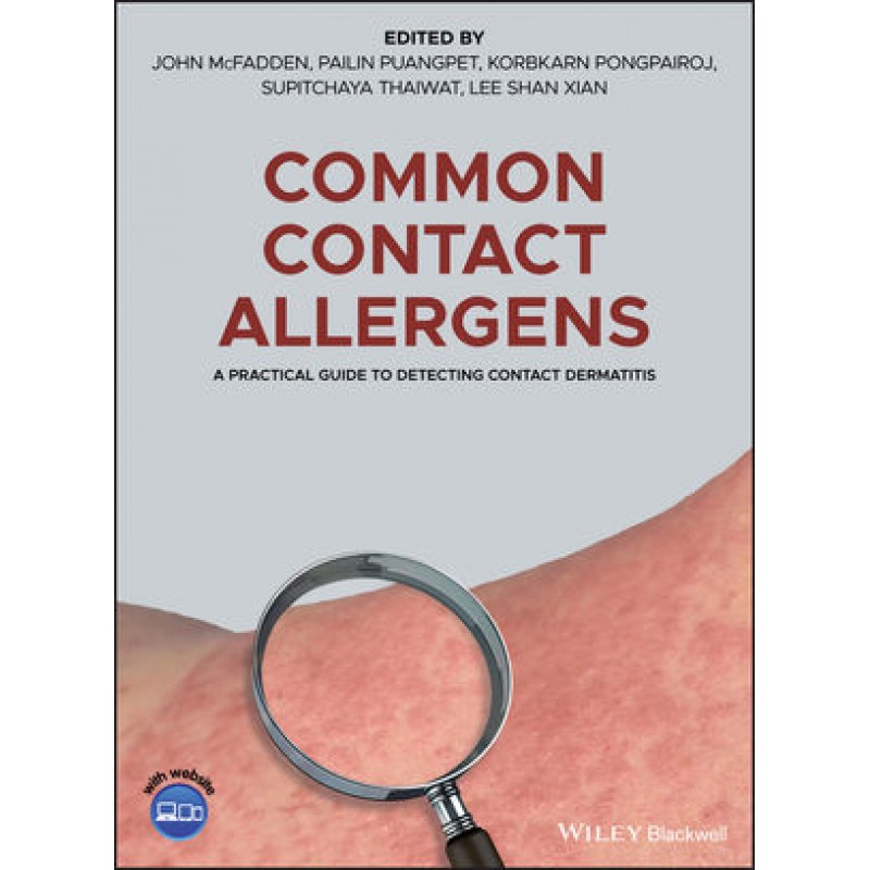 Common Contact Allergens: A Practical Guide to Detecting Contact Dermatitis