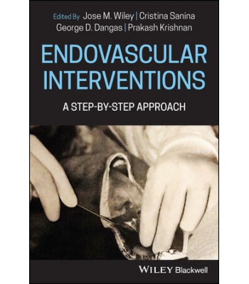 Endovascular Interventions: A Step-by-Step Approach