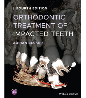 Orthodontic Treatment of Impacted Teeth, 4E