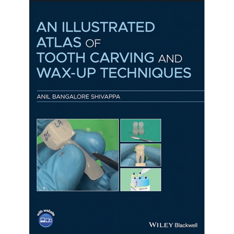 An Illustrated Atlas of Tooth Carving and Wax-Up Techniques
