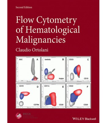 Flow Cytometry of Hematological Malignancies 2E