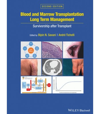 Blood and Marrow Transplantation Long Term Management: Survivorship after Transplant 2E