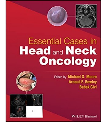 Essential Cases in Head and Neck Oncology