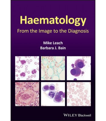 Haematology: From the Image to the Diagnosis 