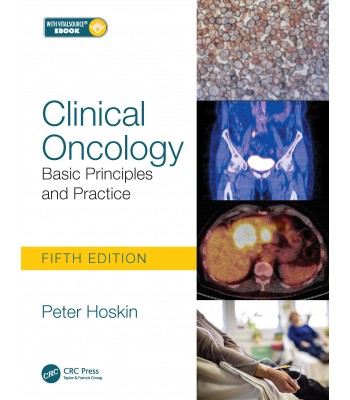 Clinical Oncology Basic Principles and Practice 5th Edition