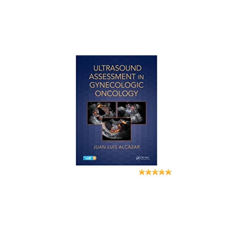 Ultrasound Assessment in Gynecologic Oncology