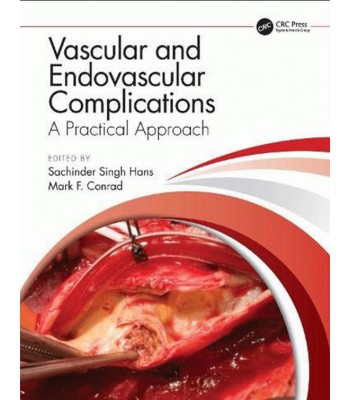 Vascular and Endovascular Complications: A Practical Approach 