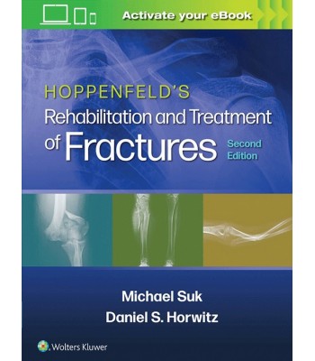 Hoppenfeld's Rehabilitation and Treatment of Fractures, 2E