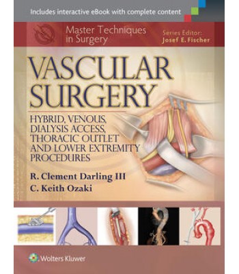 Master Techniques in Surgery: Vascular Surgery: Hybrid, Venous, Dialysis Access, Thoracic Outlet, and Lower Extremity Procedures