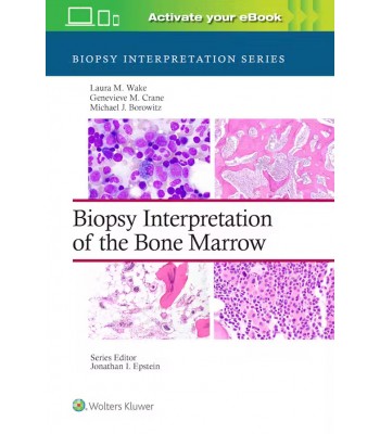 Biopsy Interpretation of the Bone Marrow, 1st Εdition, Biopsy Interpretation Series