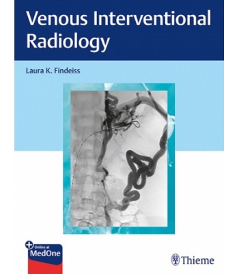Venous Interventional Radiology