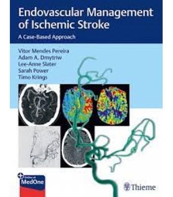  Endovascular Management of Ischemic Stroke A Case-Based Approach