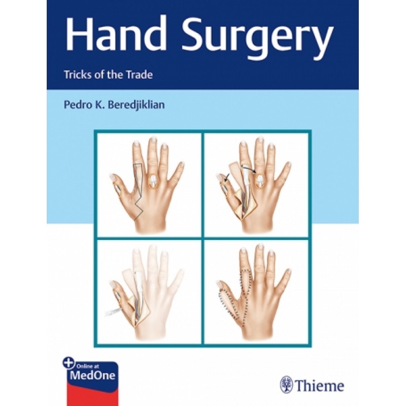 Hand Surgery - Tricks of the Trade 