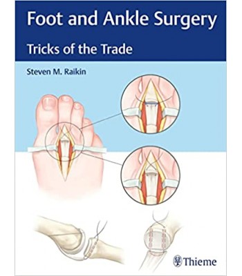  Foot and Ankle Surgery Tricks of the Trade