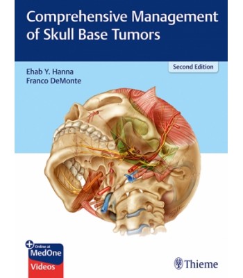 Comprehensive Management of Skull Base Tumors