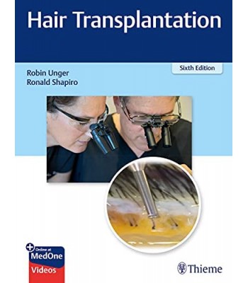  Hair Transplantation