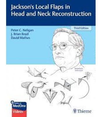 Jackson's Local Flaps in Head and Neck Reconstruction
