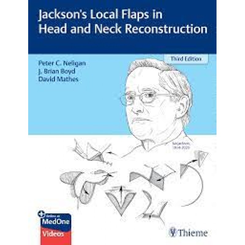 Jackson's Local Flaps in Head and Neck Reconstruction