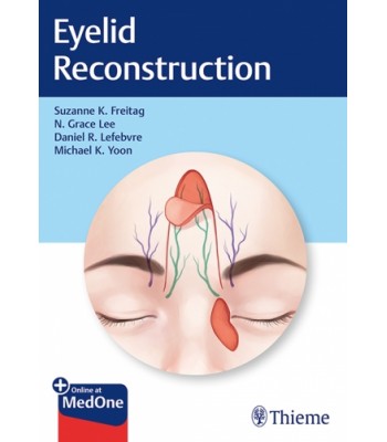 Eyelid Reconstruction