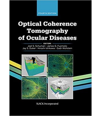 Optical Coherence Tomography of Ocular Diseases, 4E