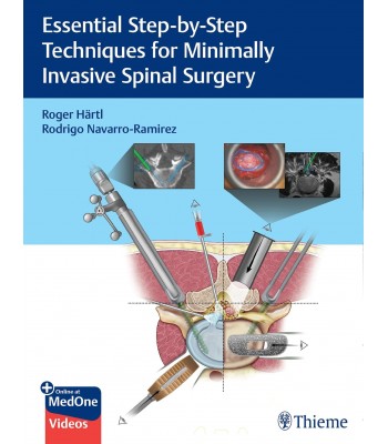 Essential Step-by-Step Techniques for Minimally Invasive Spinal Surgery 