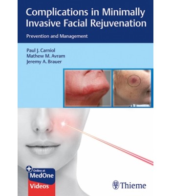 Complications in Minimally Invasive Facial Rejuvenation, Prevention and Management 
